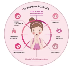 Ilustración de Rosalinda mostrando los síntomas más frecuentes de la rosácea: enrojecimiento, vasos visibles, granitos, piel sensible y ocular