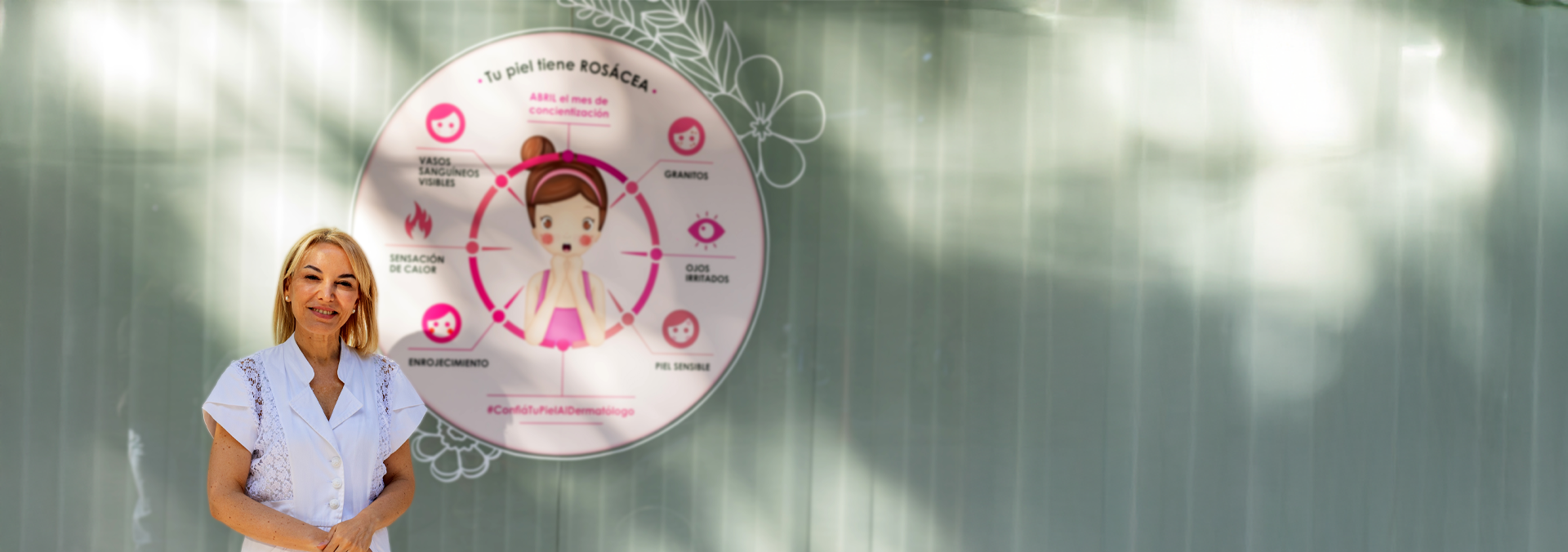 rosacea unidad clinica