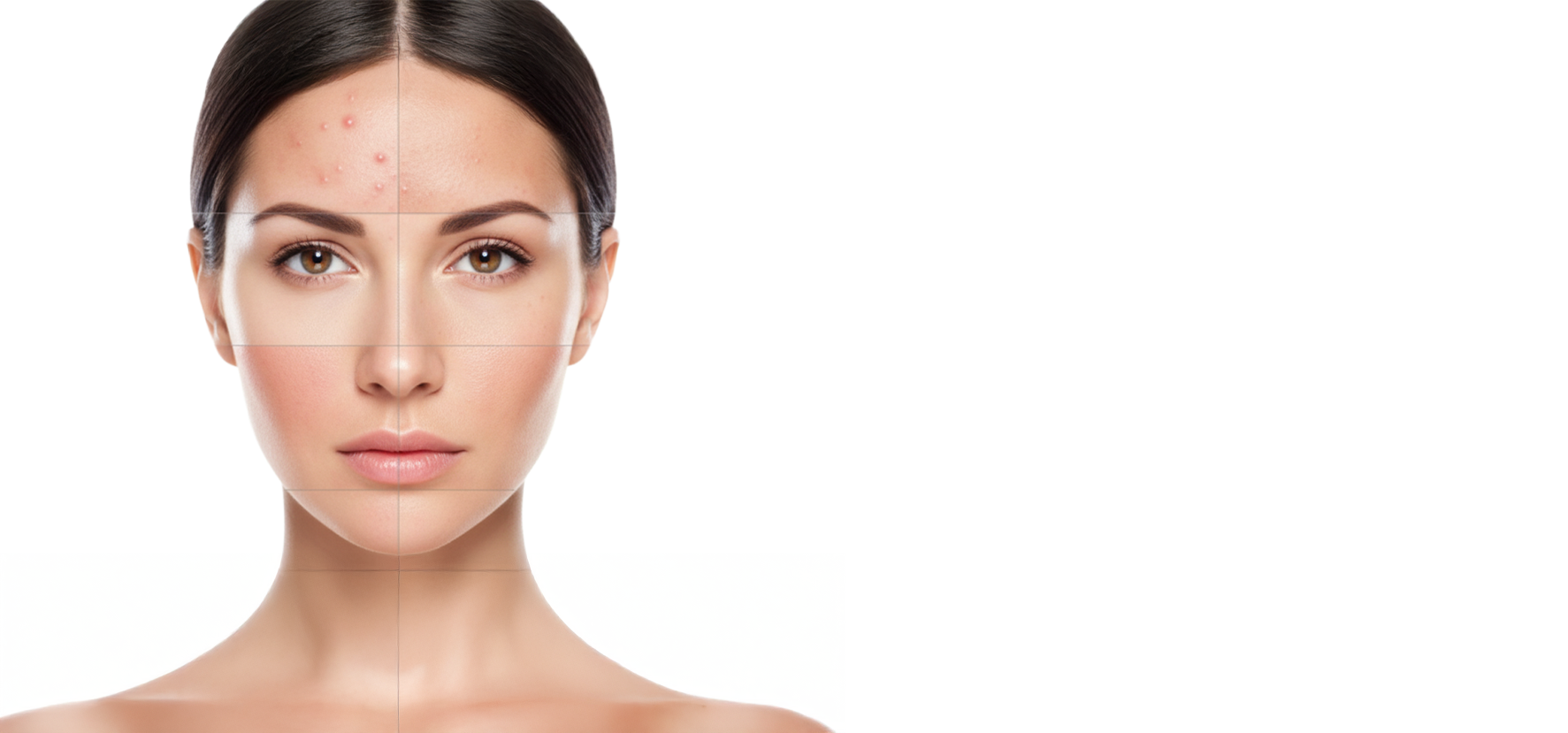 unidad clinica dermatologia de avanzada